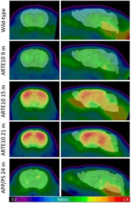 Comparison of the Amyloid Load in the Brains of Two Transgenic Alzheimer’s Disease Mouse Models Quantified by Florbetaben Positron Emission Tomography